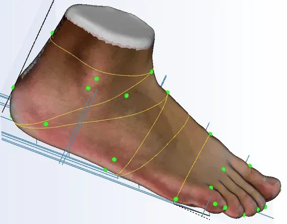 3d-voetscanner-met-modelleersoftware-van-OrthoDutch-b1dee0fb-640w